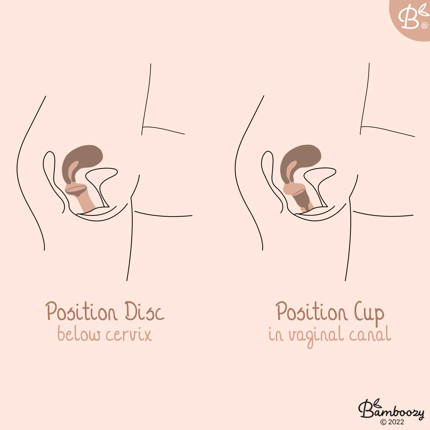 Bamboozy Disque Menstruel – Silicone Médical Réutilisable - Baume Shop