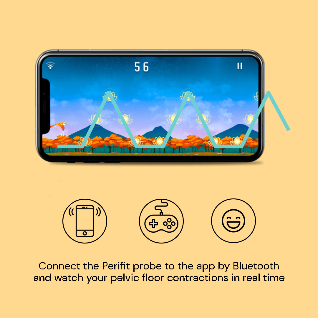 PERIFIT - Appareil d'entraînement de Kegel - Entraîneur du plancher pelvien avec application - Baume Shop